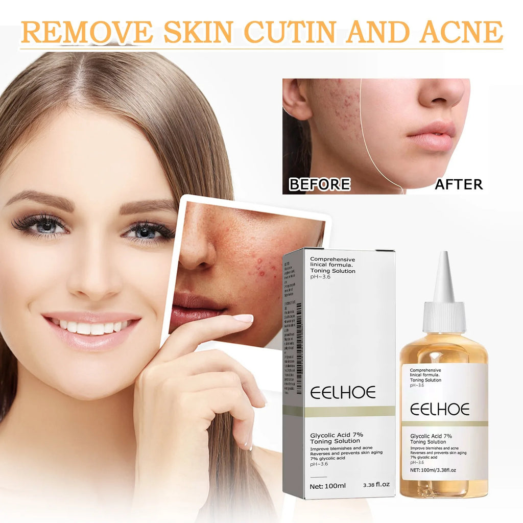 Glycolic Acid 7% Toning Solution — Glow, Exfoliate & Renew