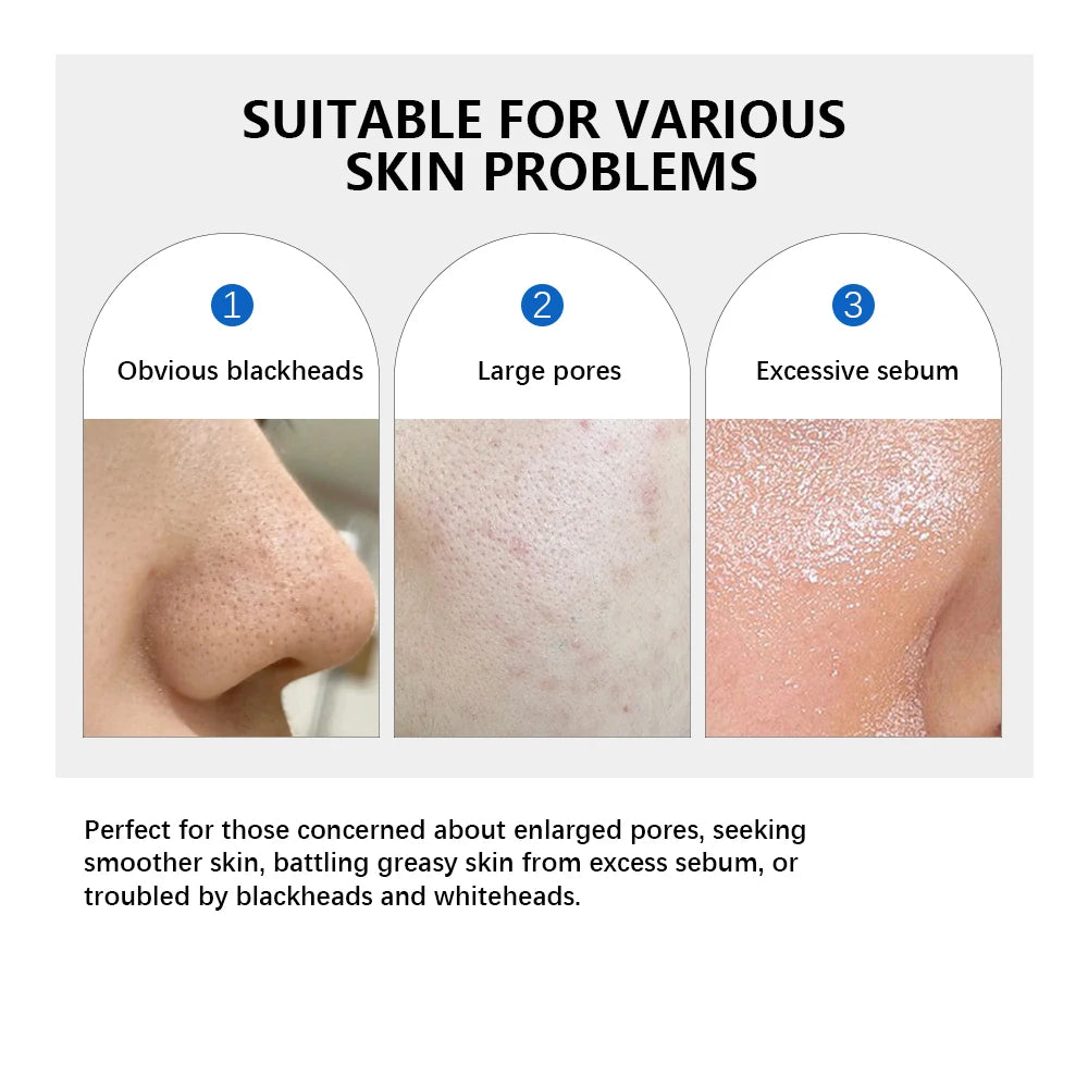 Zero Pore Pad 2.0 — Double-Textured Toner Pads for Smooth, Poreless Skin (70pcs)