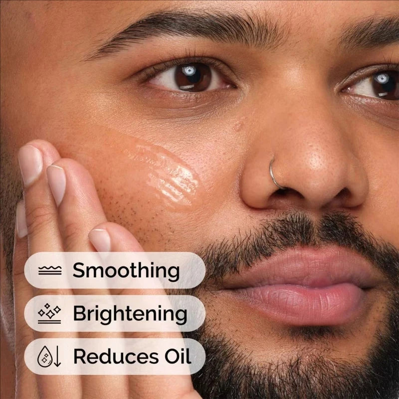 Niacinamide 10% + Zinc 1% Serum — Minimize Pores & Balance Skin (30ml)