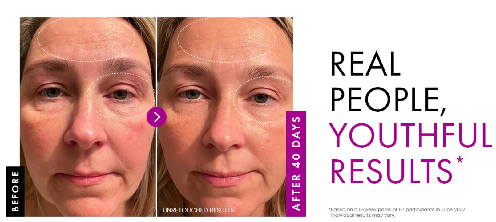 Collagen Face Cream — Plump, Nourish & Restore Youthful Skin (50g)