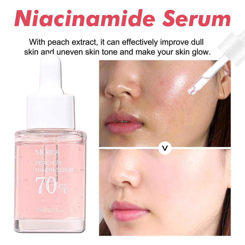 Niacinamide Serum — Dark Spot Remover & Pore Minimizer