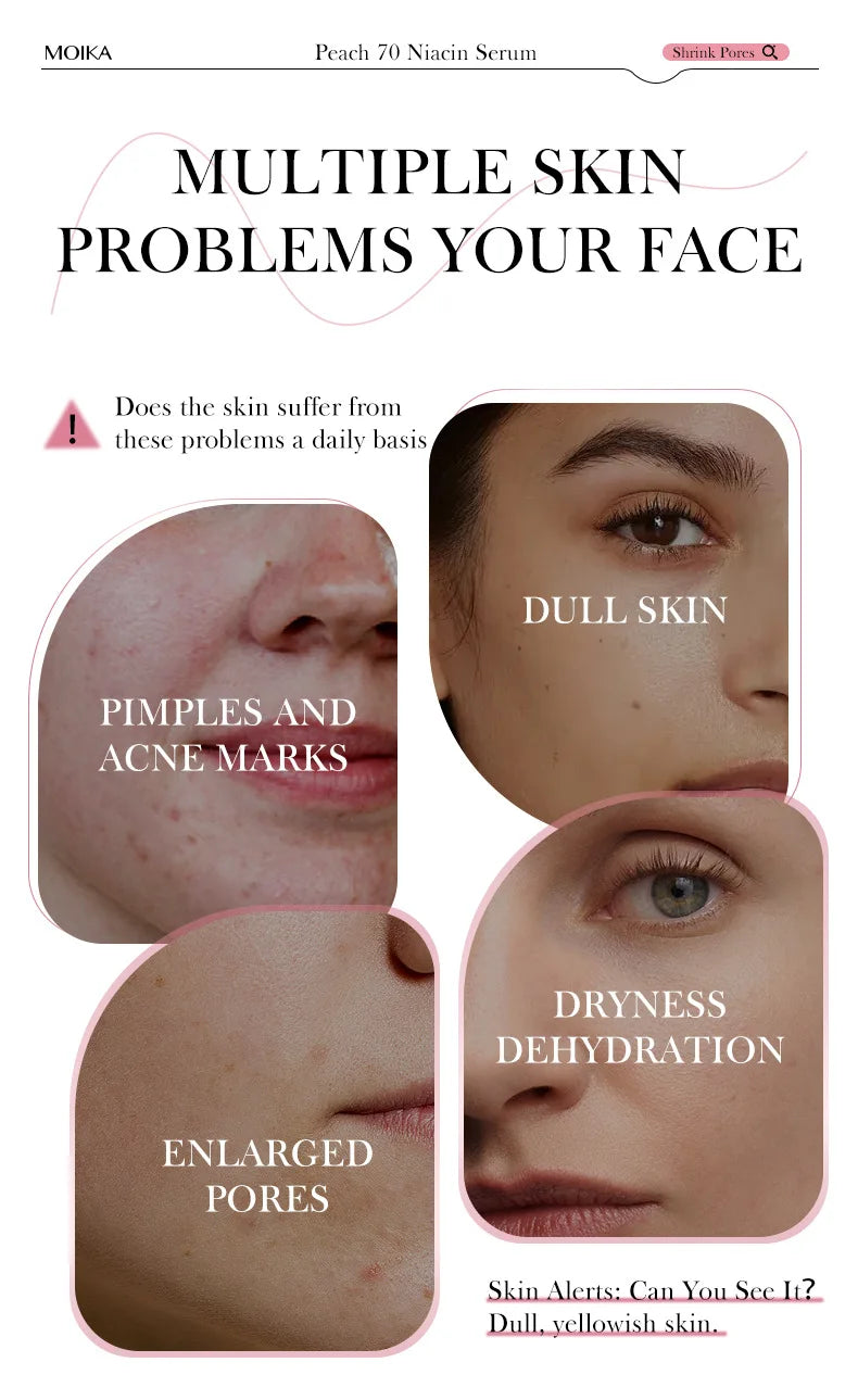 Niacinamide Serum — Dark Spot Remover & Pore Minimizer