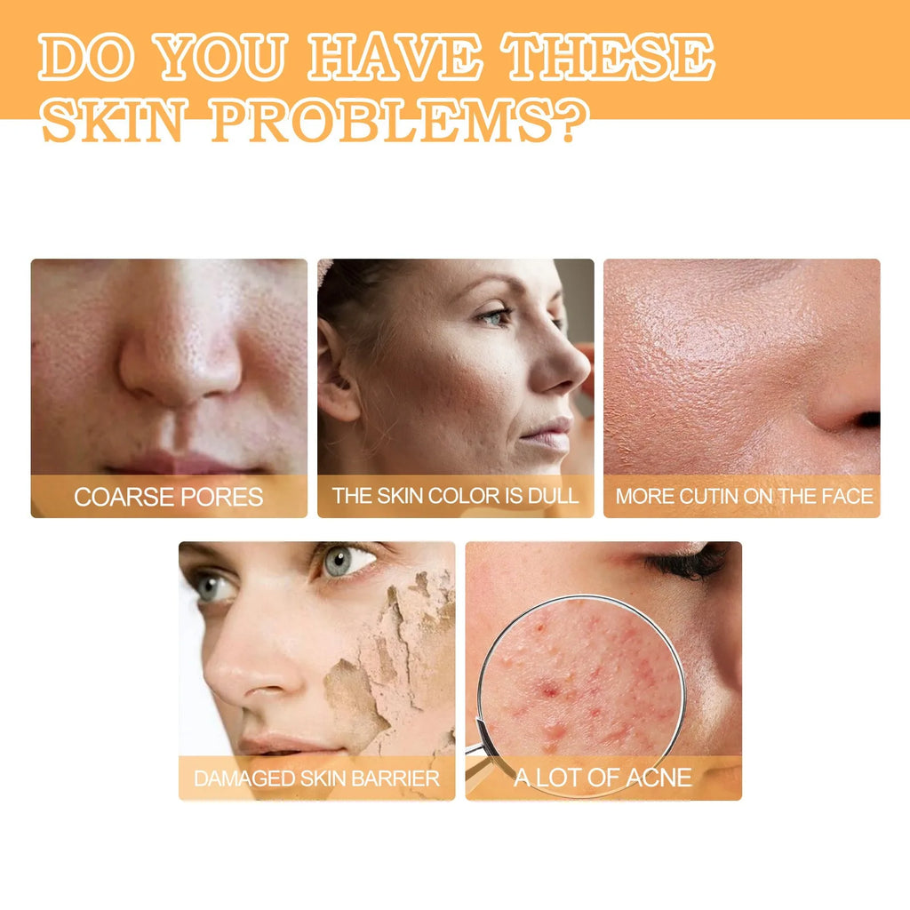 Glycolic Acid 7% Toning Solution — Glow, Exfoliate & Renew