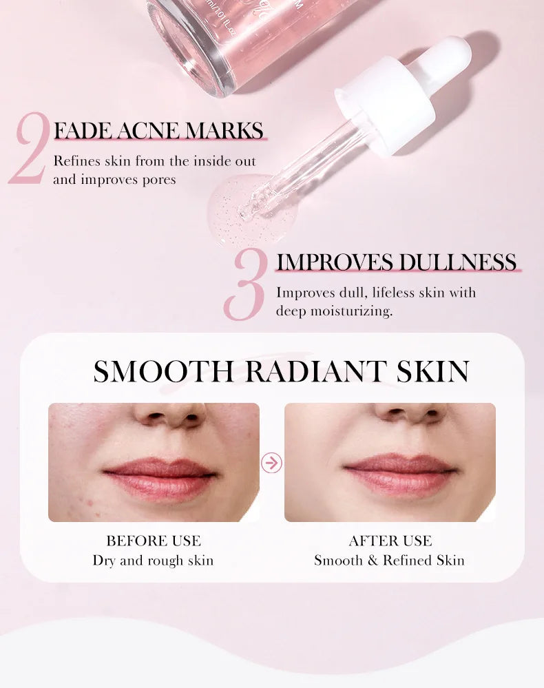 Niacinamide Serum — Dark Spot Remover & Pore Minimizer